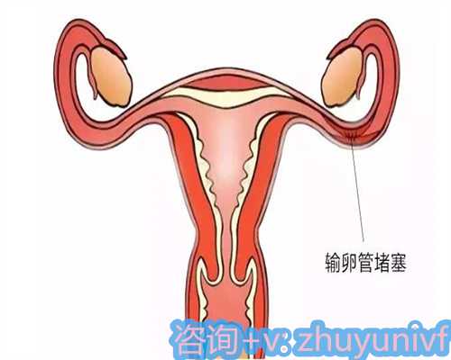 国内供卵全包，男性少精弱精中药治疗偏方！总有一款中药偏方适合你！