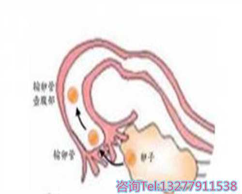 上海有没有代怀女,上海仁济医院+精子库(上海精子库仁济医院在哪)